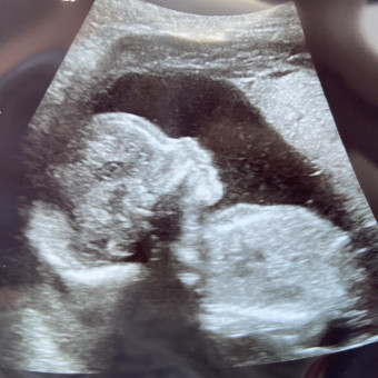 Babylist Registry Photo.