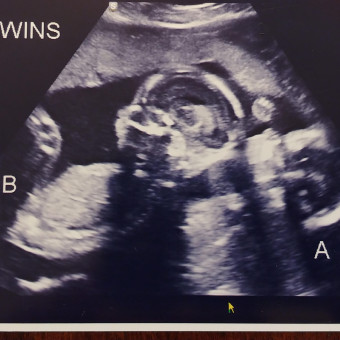 Babylist Registry Photo.