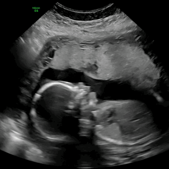 Babylist Registry Photo.
