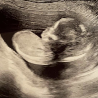 Babylist Registry Photo.
