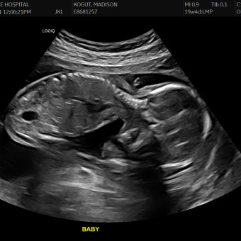 Babylist Registry Photo.