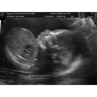 Babylist Registry Photo.