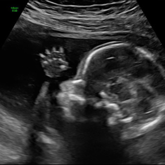 Babylist Registry Photo.