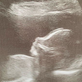 Babylist Registry Photo.