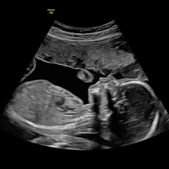 Babylist Registry Photo.