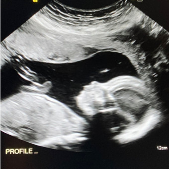 Babylist Registry Photo.