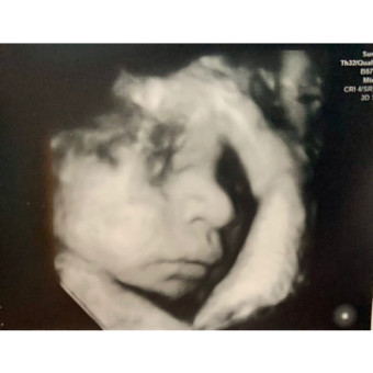 Babylist Registry Photo.