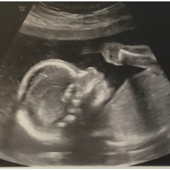 Babylist Registry Photo.