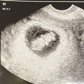 Babylist Registry Photo.