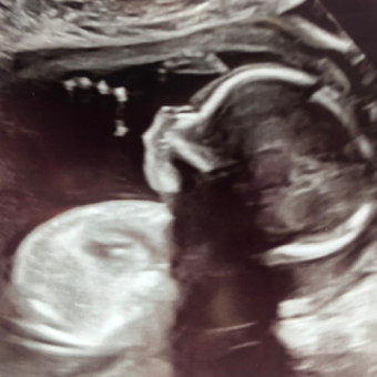 Babylist Registry Photo.