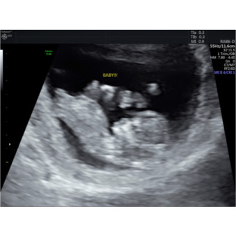 Babylist Registry Photo.