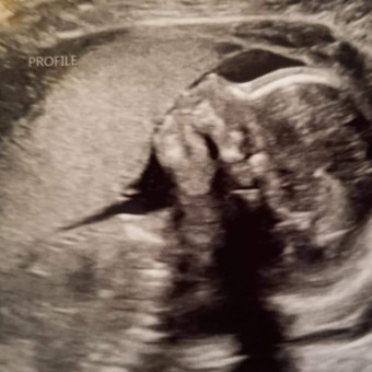 Babylist Registry Photo.
