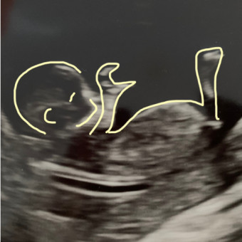 Babylist Registry Photo.