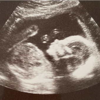Babylist Registry Photo.