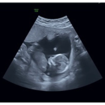 Babylist Registry Photo.