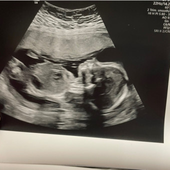 Babylist Registry Photo.