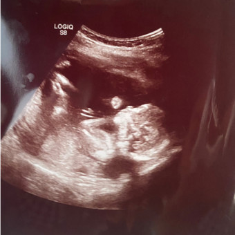 Babylist Registry Photo.