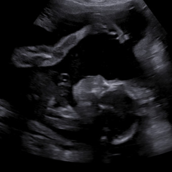 Babylist Registry Photo.