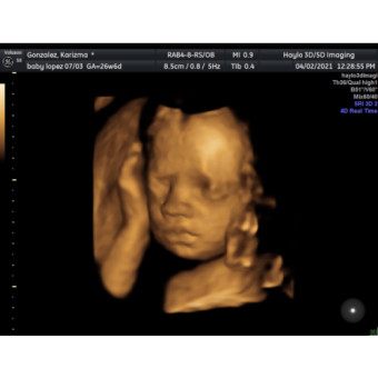 Babylist Registry Photo.
