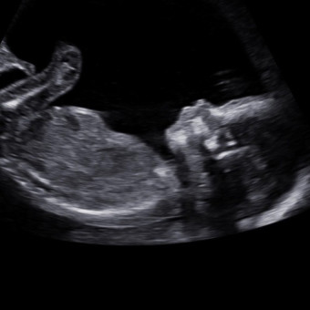Babylist Registry Photo.