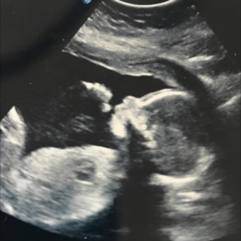 Babylist Registry Photo.