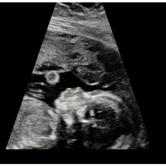 Babylist Registry Photo.