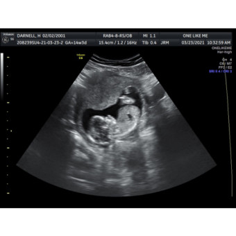 Babylist Registry Photo.