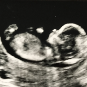 Babylist Registry Photo.