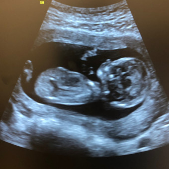 Babylist Registry Photo.
