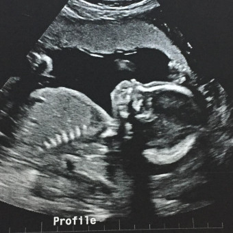 Babylist Registry Photo.