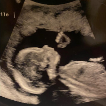 Babylist Registry Photo.