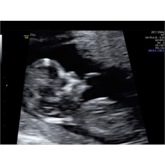 Babylist Registry Photo.