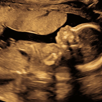 Babylist Registry Photo.