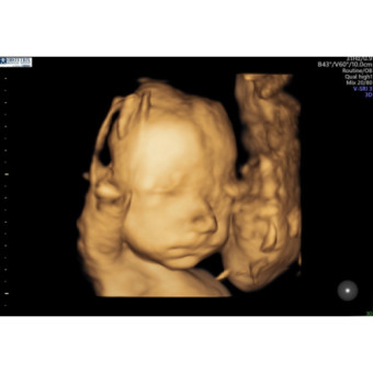 Babylist Registry Photo.