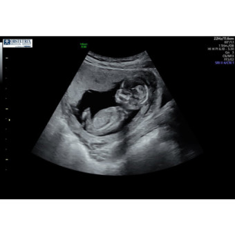 Babylist Registry Photo.