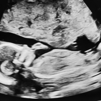 Babylist Registry Photo.