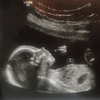 Babylist Registry Photo.