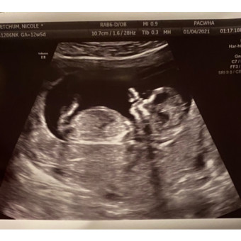 Babylist Registry Photo.