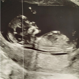 Babylist Registry Photo.