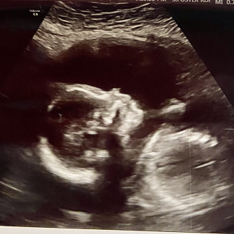 Babylist Registry Photo.