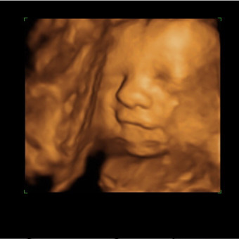 Babylist Registry Photo.
