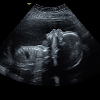 Babylist Registry Photo.