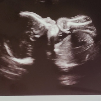 Babylist Registry Photo.