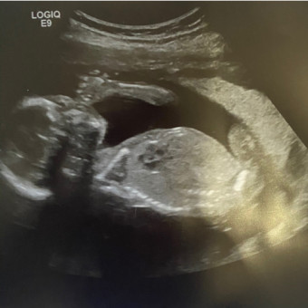 Babylist Registry Photo.