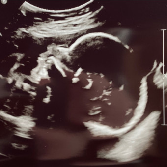 Babylist Registry Photo.
