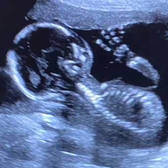 Babylist Registry Photo.