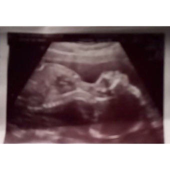 Babylist Registry Photo.