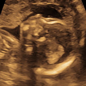 Babylist Registry Photo.