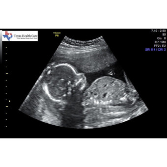 Babylist Registry Photo.