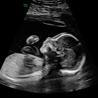 Babylist Registry Photo.